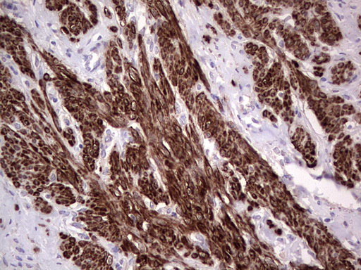 NR1I3 / CAR Antibody - Immunohistochemical staining of paraffin-embedded Human endometrium tissue within the normal limits using anti-NR1I3 mouse monoclonal antibody. (Heat-induced epitope retrieval by 1 mM EDTA in 10mM Tris, pH8.5, 120C for 3min,