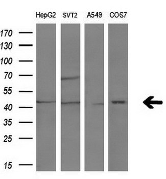NR1I3 / CAR Antibody - Western blot analysis of extracts. (10ug) from 4 different cell lines by using anti-NR1I3 monoclonal antibody. (1:200)
