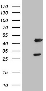 NR1I3 / CAR Antibody - HEK293T cells were transfected with the pCMV6-ENTRY control (Left lane) or pCMV6-ENTRY NR1I3 (Right lane) cDNA for 48 hrs and lysed. Equivalent amounts of cell lysates (5 ug per lane) were separated by SDS-PAGE and immunoblotted with anti-NR1I3.