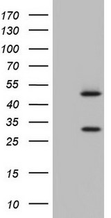 NR1I3 / CAR Antibody - HEK293T cells were transfected with the pCMV6-ENTRY control (Left lane) or pCMV6-ENTRY NR1I3 (Right lane) cDNA for 48 hrs and lysed. Equivalent amounts of cell lysates (5 ug per lane) were separated by SDS-PAGE and immunoblotted with anti-NR1I3.