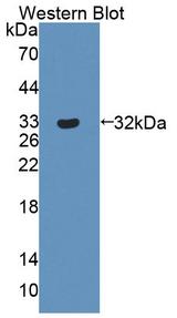 NR1I3 / CAR Antibody - Western blot of NR1I3 / CAR antibody.