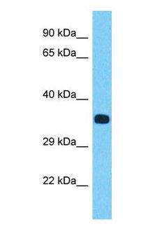 NR1I3 / CAR Antibody - Western blot of NR1I3 Antibody with Jurkat Whole Cell lysate.  This image was taken for the unconjugated form of this product. Other forms have not been tested.