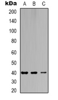 NR1I3 / CAR Antibody - Western blot analysis of CAR expression in Jurkat (A); mouse heart (B); mouse brain (C) whole cell lysates.