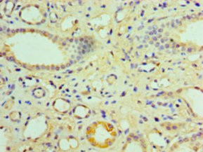 NR1I3 / CAR Antibody - Immunohistochemistry of paraffin-embedded human kidney tissue using NR1I3 Antibody at dilution of 1:100