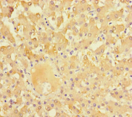 NR1I3 / CAR Antibody - Immunohistochemistry of paraffin-embedded human liver tissue using NR1I3 Antibody at dilution of 1:100