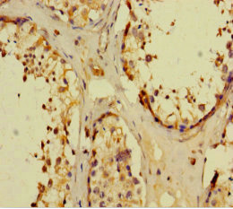 NR1I3 / CAR Antibody - Immunohistochemistry of paraffin-embedded human testis tissue using NR1I3 Antibody at dilution of 1:100