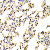 NR1I3 / CAR Antibody - Immunohistochemistry of paraffin-embedded rat lung tissue.