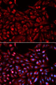 NR1I3 / CAR Antibody - Immunofluorescence analysis of U2OS cells.