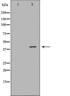 NR1I3 / CAR Antibody - Western blot analysis of HepG2 cell lysates using NR1I3 antibody. The lane on the left is treated with the antigen-specific peptide.