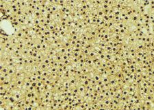 NR1I3 / CAR Antibody - 1:100 staining mouse liver tissue by IHC-P. The sample was formaldehyde fixed and a heat mediated antigen retrieval step in citrate buffer was performed. The sample was then blocked and incubated with the antibody for 1.5 hours at 22°C. An HRP conjugated goat anti-rabbit antibody was used as the secondary.