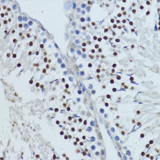 NR1I3 / CAR Antibody - Immunohistochemistry of paraffin-embedded Rat testis using NR1I3 Polyclonal Antibody at dilution of 1:200 (40x lens).