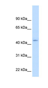NR1I3 / CAR Antibody - NR1I3 antibody ARP45623_T100-NP_005113-NR1I3(nuclear receptor subfamily 1, group I, member 3) Antibody Western blot of Fetal Liver lysate.  This image was taken for the unconjugated form of this product. Other forms have not been tested.