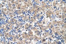 NR1I3 / CAR Antibody - NR1I3 antibody ARP45623_T100-NP_005113-NR1I3(nuclear receptor subfamily 1, group I, member 3) Antibody IHC of formalin-fixed, paraffin-embedded human Liver. Positive label: Hepatocytes indicated with arrows. Antibody concentration 4-8 ug/ml. Magnification 400X.  This image was taken for the unconjugated form of this product. Other forms have not been tested.