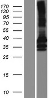 NR1I3 / CAR Protein - Western validation with an anti-DDK antibody * L: Control HEK293 lysate R: Over-expression lysate