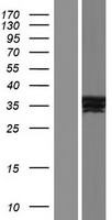 NR1I3 / CAR Protein - Western validation with an anti-DDK antibody * L: Control HEK293 lysate R: Over-expression lysate