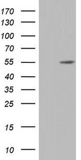 NR2C1 Antibody - HEK293T cells were transfected with the pCMV6-ENTRY control (Left lane) or pCMV6-ENTRY NR2C1 (Right lane) cDNA for 48 hrs and lysed. Equivalent amounts of cell lysates (5 ug per lane) were separated by SDS-PAGE and immunoblotted with anti-NR2C1.