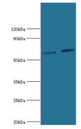 NR2C1 Antibody - Western blot. All lanes: Nuclear receptor subfamily 2 group C member 1 antibody at 10 ug/ml. Lane 1: PC-3 whole cell lysate. Lane 2: 293T whole cell lysate. Secondary antibody: Goat polyclonal to rabbit at 1:10000 dilution. Predicted band size: 67 kDa. Observed band size: 67 kDa.