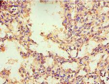 NR2C1 Antibody - Immunohistochemistry of paraffin-embedded human lung using antibody at 1:100 dilution.
