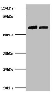 NR2C1 Antibody - Western blot All lanes: Nuclear receptor subfamily 2 group C member 1 antibody at 10µg/ml Lane 1: PC-3 whole cell lysate Lane 2: 293T whole cell lysate Secondary Goat polyclonal to rabbit IgG at 1/10000 dilution Predicted band size: 68, 52, 54 kDa Observed band size: 68 kDa