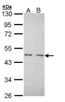 NR2C1 Antibody - Sample (30 ug of whole cell lysate). A: A431. B: H1299. 10% SDS PAGE. NR2C1 antibody diluted at 1:1000