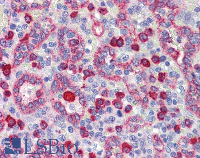 NR2C1 Antibody - Anti-NR2C1 / TR2-11 antibody IHC of human spleen. Immunohistochemistry of formalin-fixed, paraffin-embedded tissue after heat-induced antigen retrieval. Antibody concentration 5 ug/ml.  This image was taken for the unconjugated form of this product. Other forms have not been tested.
