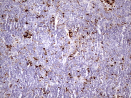 NR2C2 / TAK1 Antibody - Immunohistochemical staining of paraffin-embedded Human lymph node tissue within the normal limits using anti-NR2C2 mouse monoclonal antibody. (Heat-induced epitope retrieval by 1 mM EDTA in 10mM Tris, pH8.5, 120C for 3min. (1:150)