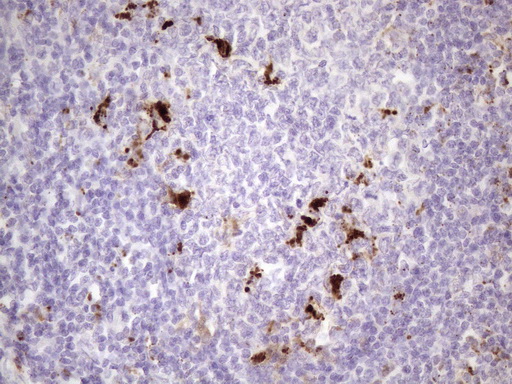 NR2C2 / TAK1 Antibody - Immunohistochemical staining of paraffin-embedded Human tonsil within the normal limits using anti-NR2C2 mouse monoclonal antibody. (Heat-induced epitope retrieval by 1 mM EDTA in 10mM Tris, pH8.5, 120C for 3min. (1:150)