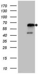 NR2C2 / TAK1 Antibody - HEK293T cells were transfected with the pCMV6-ENTRY control. (Left lane) or pCMV6-ENTRY NR2C2. (Right lane) cDNA for 48 hrs and lysed. Equivalent amounts of cell lysates. (5 ug per lane) were separated by SDS-PAGE and immunoblotted with anti-NR2C2.