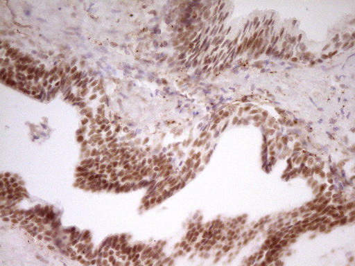 NR2C2 / TAK1 Antibody - Immunohistochemical staining of paraffin-embedded Human prostate tissue within the normal limits using anti-NR2C2 mouse monoclonal antibody. (Heat-induced epitope retrieval by 1 mM EDTA in 10mM Tris, pH8.5, 120C for 3min,