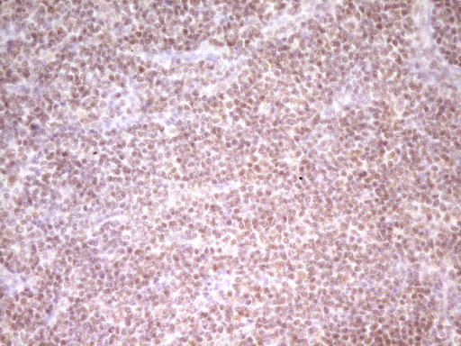 NR2C2 / TAK1 Antibody - Immunohistochemical staining of paraffin-embedded Human lymph node tissue within the normal limits using anti-NR2C2 mouse monoclonal antibody. (Heat-induced epitope retrieval by 1 mM EDTA in 10mM Tris, pH8.5, 120C for 3min,