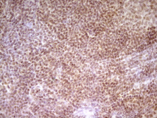 NR2C2 / TAK1 Antibody - Immunohistochemical staining of paraffin-embedded Human tonsil within the normal limits using anti-NR2C2 mouse monoclonal antibody. (Heat-induced epitope retrieval by 1 mM EDTA in 10mM Tris, pH8.5, 120C for 3min,