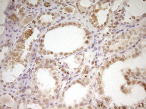 NR2C2 / TAK1 Antibody - Immunohistochemical staining of paraffin-embedded Human Kidney tissue within the normal limits using anti-NR2C2 mouse monoclonal antibody. (Heat-induced epitope retrieval by 1 mM EDTA in 10mM Tris, pH8.5, 120C for 3min,