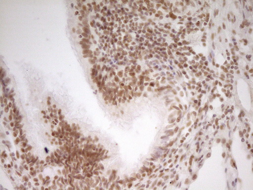 NR2C2 / TAK1 Antibody - Immunohistochemical staining of paraffin-embedded Human lung tissue within the normal limits using anti-NR2C2 mouse monoclonal antibody. (Heat-induced epitope retrieval by 1 mM EDTA in 10mM Tris, pH8.5, 120C for 3min,