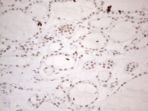 NR2C2 / TAK1 Antibody - Immunohistochemical staining of paraffin-embedded Human thyroid tissue within the normal limits using anti-NR2C2 mouse monoclonal antibody. (Heat-induced epitope retrieval by 1mM EDTA in 10mM Tris buffer. (pH8.5) at 120°C for 3 min. (1:150)