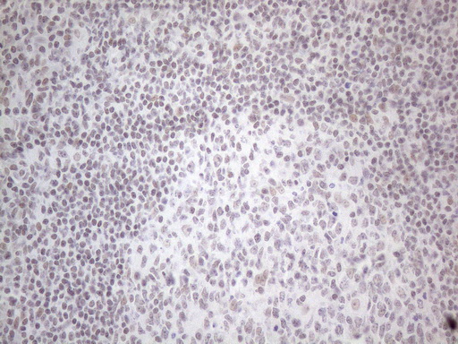 NR2C2 / TAK1 Antibody - Immunohistochemical staining of paraffin-embedded Human tonsil within the normal limits using anti-NR2C2 mouse monoclonal antibody. (Heat-induced epitope retrieval by 1mM EDTA in 10mM Tris buffer. (pH8.5) at 120°C for 3 min. (1:150)