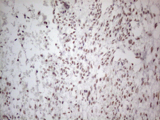 NR2C2 / TAK1 Antibody - Immunohistochemical staining of paraffin-embedded Human Ovary tissue within the normal limits using anti-NR2C2 mouse monoclonal antibody. (Heat-induced epitope retrieval by 1mM EDTA in 10mM Tris buffer. (pH8.5) at 120°C for 3 min. (1:150)