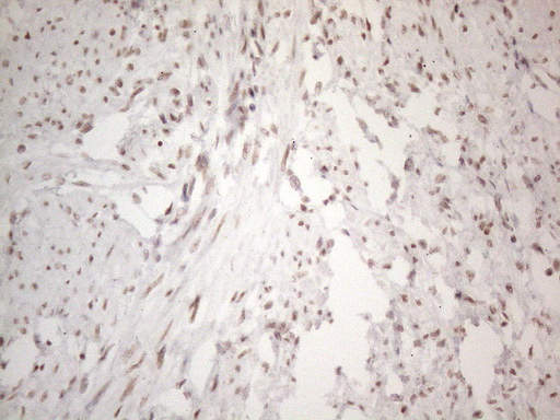 NR2C2 / TAK1 Antibody - Immunohistochemical staining of paraffin-embedded Human endometrium tissue within the normal limits using anti-NR2C2 mouse monoclonal antibody. (Heat-induced epitope retrieval by 1mM EDTA in 10mM Tris buffer. (pH8.5) at 120°C for 3 min. (1:150)