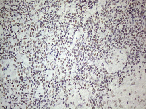 NR2C2 / TAK1 Antibody - Immunohistochemical staining of paraffin-embedded Human lymph node tissue within the normal limits using anti-NR2C2 mouse monoclonal antibody. (Heat-induced epitope retrieval by 1mM EDTA in 10mM Tris buffer. (pH8.5) at 120°C for 3 min. (1:150)