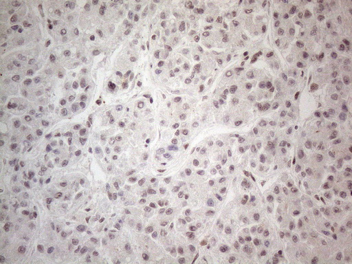 NR2C2 / TAK1 Antibody - Immunohistochemical staining of paraffin-embedded Human liver tissue within the normal limits using anti-NR2C2 mouse monoclonal antibody. (Heat-induced epitope retrieval by 1mM EDTA in 10mM Tris buffer. (pH8.5) at 120°C for 3 min. (1:150)