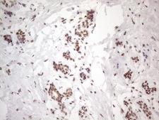 NR2C2 / TAK1 Antibody - Immunohistochemical staining of paraffin-embedded Human breast tissue within the normal limits using anti-NR2C2 mouse monoclonal antibody. (Heat-induced epitope retrieval by 1mM EDTA in 10mM Tris buffer. (pH8.5) at 120°C for 3 min. (1:150)