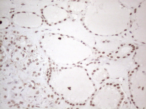 NR2C2 / TAK1 Antibody - Immunohistochemical staining of paraffin-embedded Human thyroid tissue within the normal limits using anti-NR2C2 mouse monoclonal antibody. (Heat-induced epitope retrieval by 1mM EDTA in 10mM Tris buffer. (pH8.5) at 120°C for 3 min. (1:150)