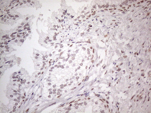 NR2C2 / TAK1 Antibody - Immunohistochemical staining of paraffin-embedded Human prostate tissue within the normal limits using anti-NR2C2 mouse monoclonal antibody. (Heat-induced epitope retrieval by 1mM EDTA in 10mM Tris buffer. (pH8.5) at 120°C for 3 min. (1:150)