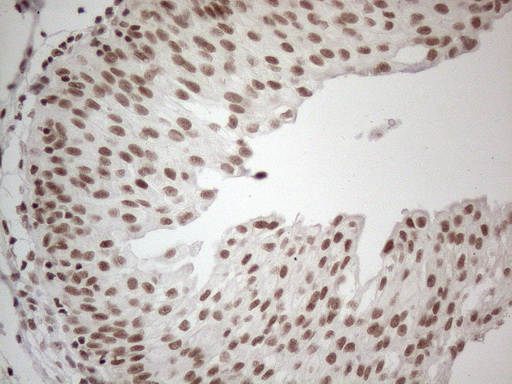 NR2C2 / TAK1 Antibody - Immunohistochemical staining of paraffin-embedded Human bladder tissue within the normal limits using anti-NR2C2 mouse monoclonal antibody. (Heat-induced epitope retrieval by 1mM EDTA in 10mM Tris buffer. (pH8.5) at 120°C for 3 min. (1:150)