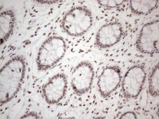 NR2C2 / TAK1 Antibody - Immunohistochemical staining of paraffin-embedded Human colon tissue within the normal limits using anti-NR2C2 mouse monoclonal antibody. (Heat-induced epitope retrieval by 1mM EDTA in 10mM Tris buffer. (pH8.5) at 120°C for 3 min. (1:150)