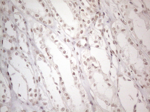 NR2C2 / TAK1 Antibody - Immunohistochemical staining of paraffin-embedded Human Kidney tissue within the normal limits using anti-NR2C2 mouse monoclonal antibody. (Heat-induced epitope retrieval by 1mM EDTA in 10mM Tris buffer. (pH8.5) at 120°C for 3 min. (1:150)