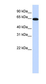 NR2C2 / TAK1 Antibody - NR2C2 antibody Western blot of Fetal Brain lysate. This image was taken for the unconjugated form of this product. Other forms have not been tested.