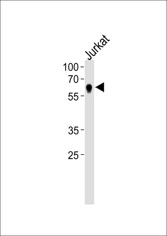NR2C2 / TAK1 Antibody - NR2C2 Antibody western blot of Jurkat cell line lysates (35 ug/lane). The NR2C2 antibody detected the NR2C2 protein (arrow).