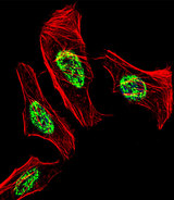 NR2C2 / TAK1 Antibody - Fluorescent confocal image of HeLa cell stained with NR2C2 Antibody. HeLa cells were fixed with 4% PFA (20 min), permeabilized with Triton X-100 (0.1%, 10 min), then incubated with NR2C2 primary antibody (1:25, 1 h at 37°C). For secondary antibody, Alexa Fluor 488 conjugated donkey anti-rabbit antibody (green) was used (1:400, 50 min at 37°C). Cytoplasmic actin was counterstained with Alexa Fluor 555 (red) conjugated Phalloidin (7units/ml, 1 h at 37°C). Nuclei were counterstained with DAPI (blue) (10 ug/ml, 10 min). NR2C2 immunoreactivity is localized to Nucleus significantly.