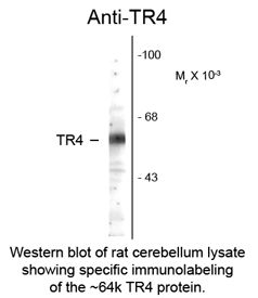 NR2C2 / TAK1 Antibody
