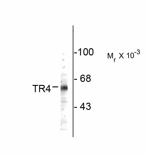 NR2C2 / TAK1 Antibody - Western Blot of NR2C2 antibody. Western blot of rat cerebellum lysate showing specific immunolabeling of ~ 64k TR4 protein